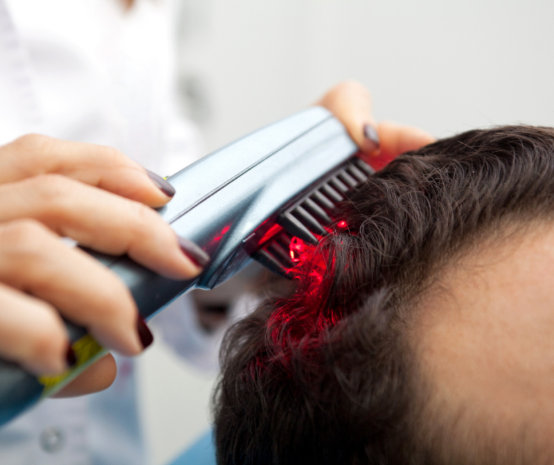 Crown Hair - Laser Hair Therapy